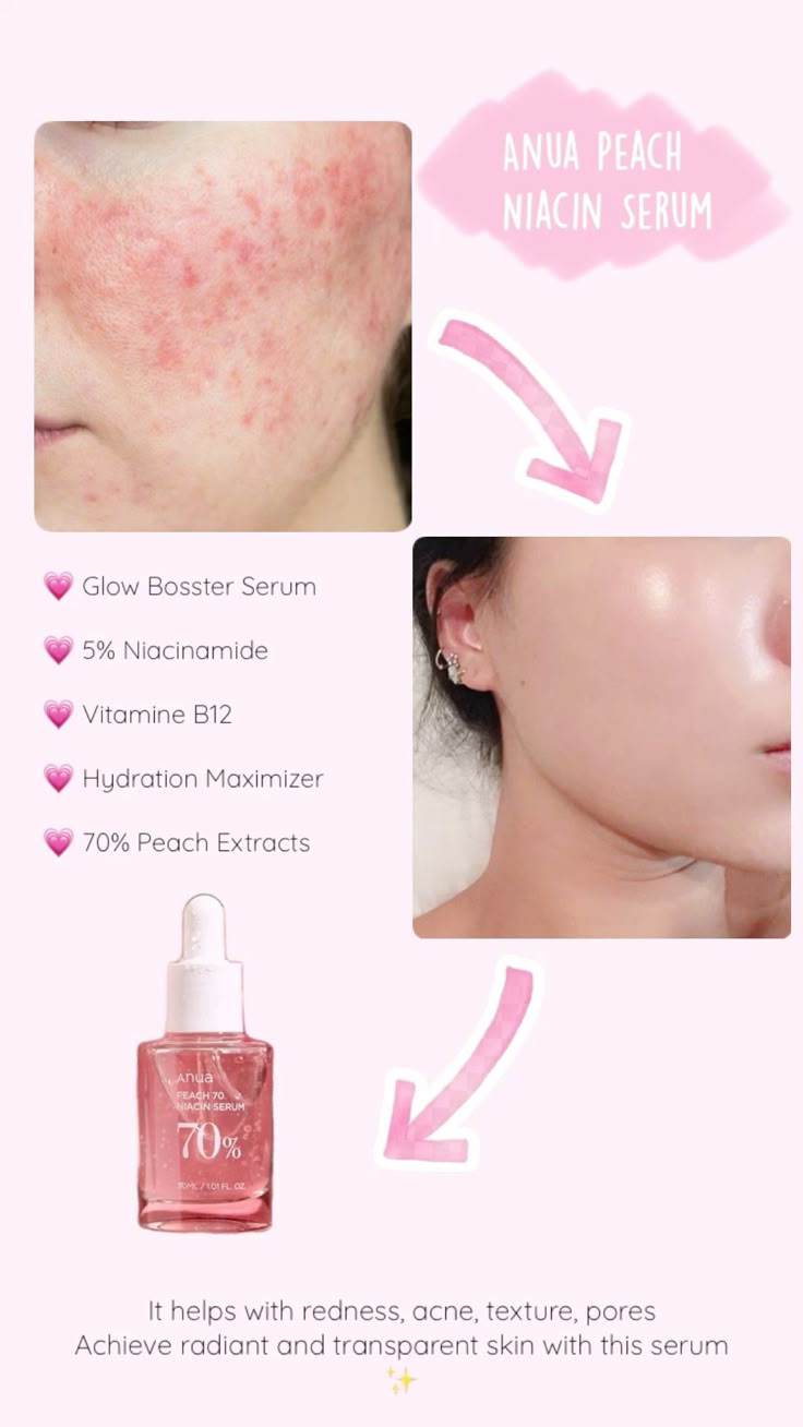 Anua Peach 70 Niacinamide Serum 30ml